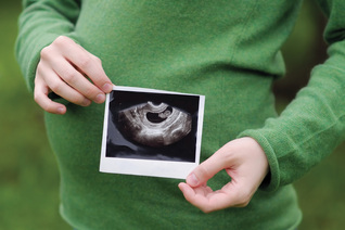 Pro-LifeEssay_Ultrasound