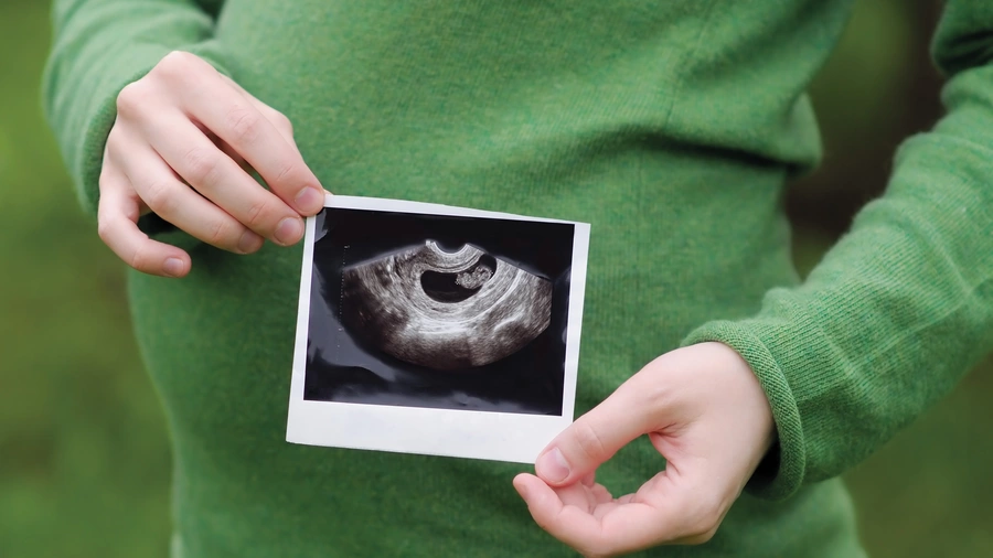 Pro-LifeEssay_Ultrasound