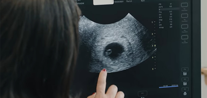 Life shown on an ultra sound machine.